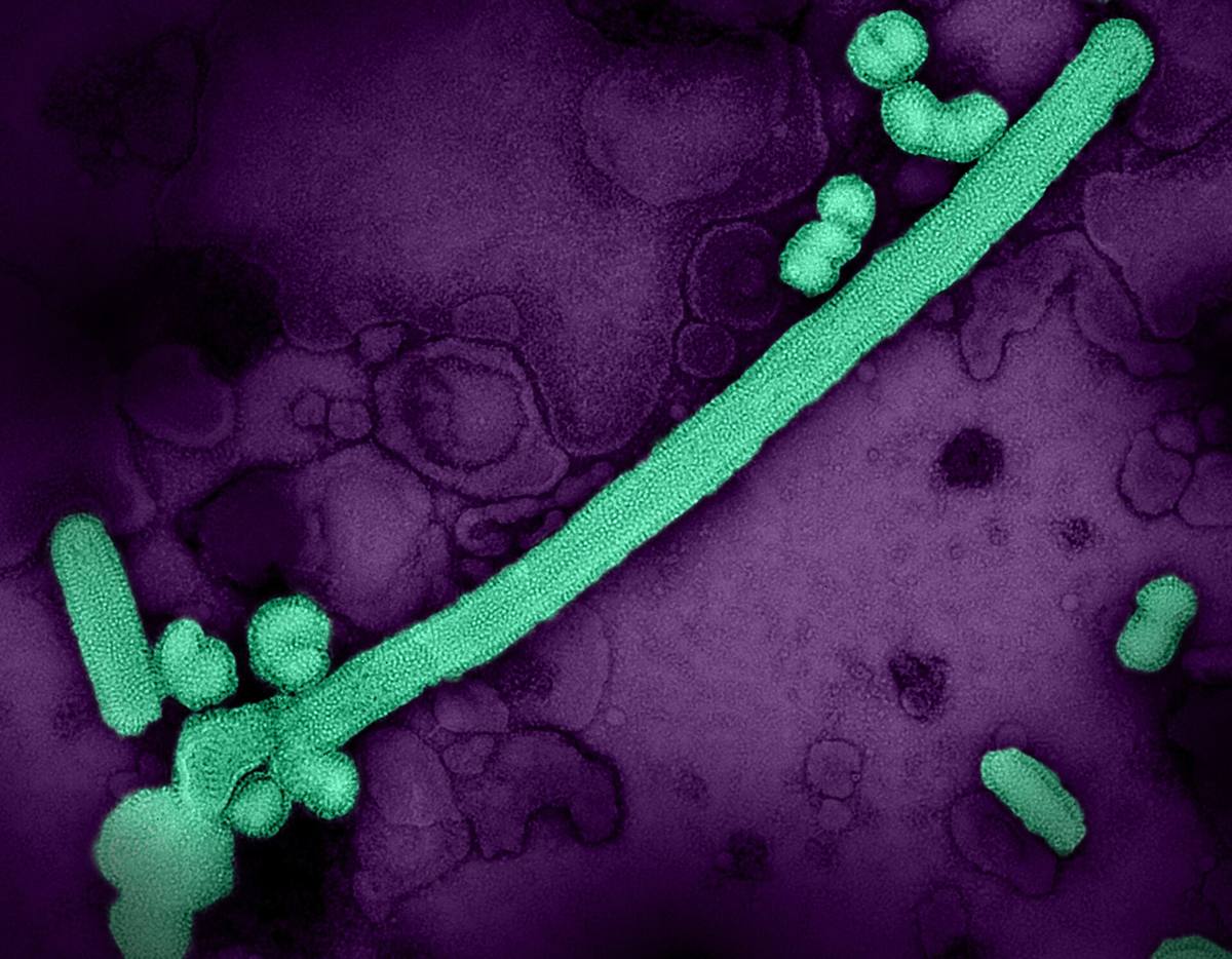 Elektronový mikrosnímek částic viru chřipky A podtypu H3N2