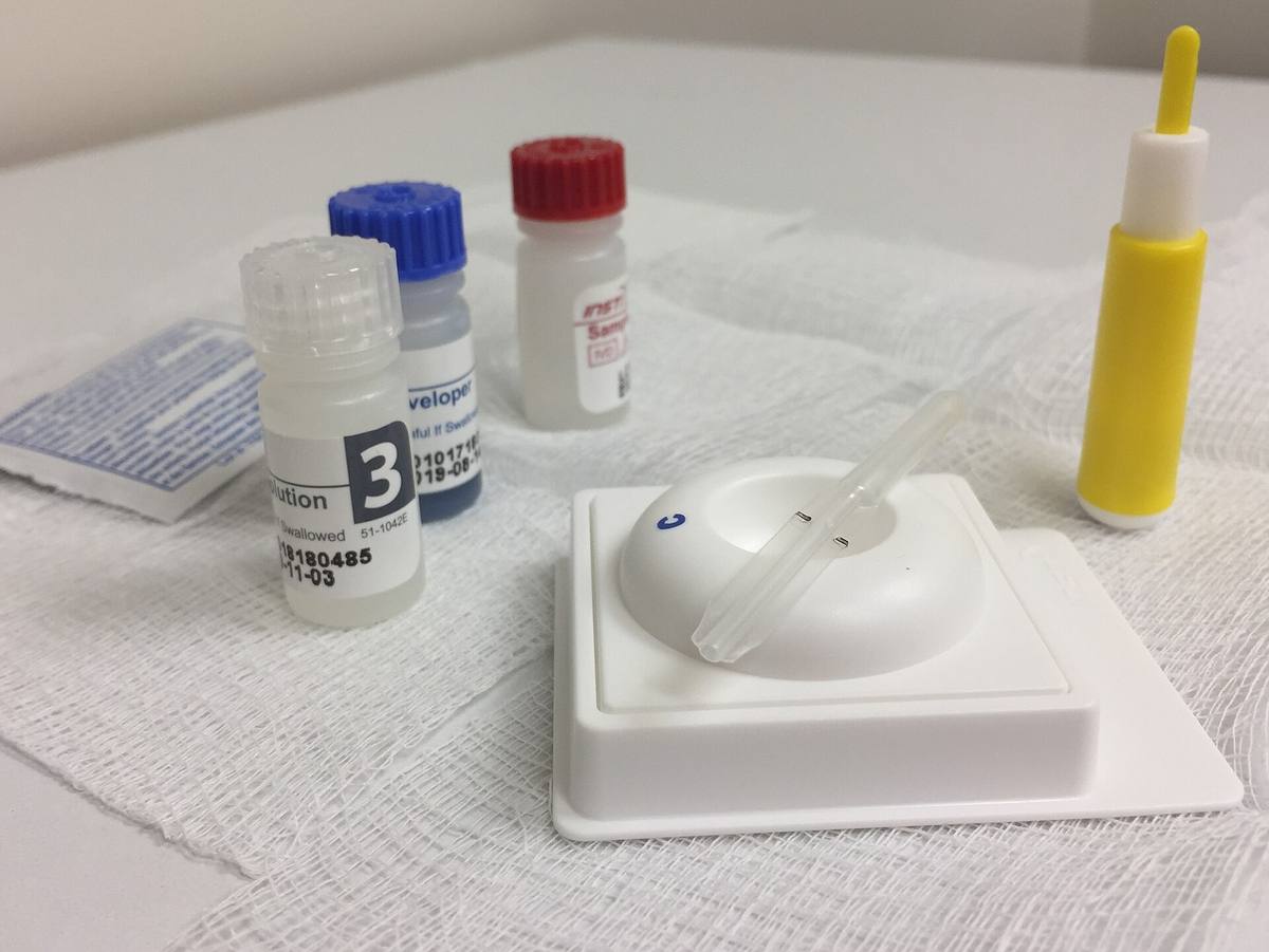 Souprava na průkaz protilátek proti HIV rozložená na laboratorním stole.